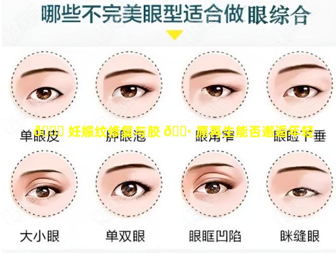 🐝 妊娠纹修复与胶 🌷 原再生能否邂逅年轻